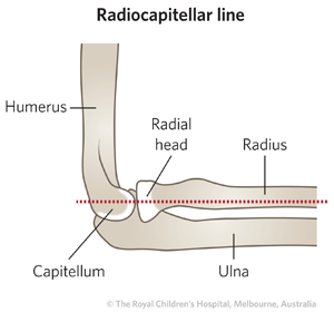 ED_Section 6_Box_RADIOCAPITELLAR LINE_Lat.jpg